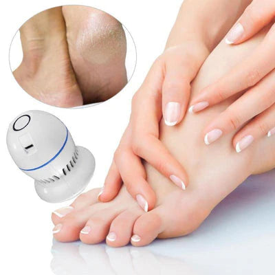 Exfoliador de Pies Eléctrico – Elimina Callos en poco tiempo – Logra Pies Suaves y Presentables en Casa Hoy Mismo