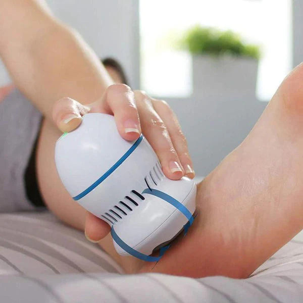 Exfoliador de Pies Eléctrico – Elimina Callos en poco tiempo – Logra Pies Suaves y Presentables en Casa Hoy Mismo